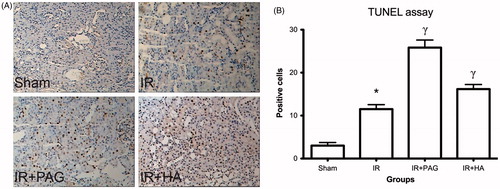 Figure 5. Apoptosis in kidney after IRI. (A) Representative photographs of TUNEL-stained kidney tissues from different groups. (B) Numbers of apoptotic cells were estimated and compared among different groups. Notes: Data shown are mean ± SEM; *statistically significant from sham group (p < 0.01); γstatistically significant from IR group (p < 0.05); n = 6 each.