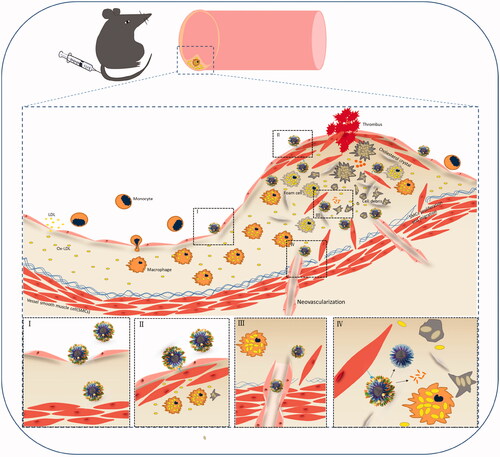 Scheme 1. Schematic diagram of possible target routes of multifunctional NPs in plaque. NPs may locate the atherosclerotic plaque by crossing the permeable atherosclerotic endothelium (I) and/or actively target VSMCs of fibrous caps (II), or location through the dysfunctional neovessels in the adventitia (III). The nanomedicine is released in the slightly acidic environment of lesions in a controlled manner (IV).