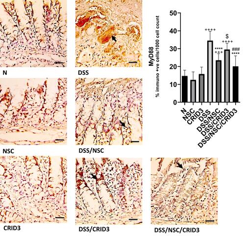 Figure 4 Immunostaining of MyD88. Photomicrographs of specimens from: (N), (NSC), and (CRID3) show scanty MyD88 expression; (DSS), shows marked expression of MyD88 in the damaged crypts and inflammatory cells (filled arrow), such as polymorphonuclear leukocytes and monocytes; (DSS/NSC), shows moderate decrease in the MyD88 expression (filled arrow); (DSS/CRID3), shows increased expression of MyD88 (filled arrow); (DSS/NSC/CRID3), displays significant decrease in the MyD88 expression in the epithelia of glands and crypts (filled arrow). As shown in MyD88 immunoreactivity evaluation figure, a significant decrease in the percentage of MyD88 immunopositive cells/1000 counted cells was detected in rats treated with DSS/NSC and DSS/NSC/CRID3 compared with the untreated DSS rats. The insignificant change in the percentage of MyD88 immunopositive cells/1000 counted cells was observed in rats treated with CRID3. MyD88 IHC, bar = 50 µm. ++++P < 0.0001 vs N, +++P < 0.001 vs N, ****P < 0.0001 vs DSS, ###P < 0.001 vs DSS/CRID3, $P < 0.05 DSS/CRID3 vs DSS/NSC.