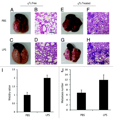 Figure 1. LPS induced pulmonary inflammation and promoted metastasis. (A and B) PBS-treated mouse was disposed as a control. (C and D) Mouse was injected with LPS for 3 d to confirm an inflammation model. (E–H) Mouse received 4T1 cell inoculation and lung metastasis number was counted after 3 wk. (I and J) Wet/dry weight ratio of lungs and number of metastatic foci per mice. Bar is 200 μm.