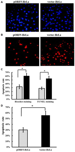Figure 3. Inhibitory effect of pORF5 protein on HeLa cells apoptosis induced by TNF-α. (A) Hoechst staining of pORF5-HeLa cells and vector-HeLa cells treated with TNF-α for 6 h. (B) TUNEL staining of pORF5-HeLa cells and vector-HeLa cells treated with TNF-α for 6 h under a fluorescence microscope (200×). (C) Quantification of apoptosis rate performed by counting apoptotic cells from five randomly selected fields, and a significant increase in pORF5-HeLa cells when compared to vector-HeLa cells. (D) Percentage of apoptotic cells detected by flow cytometry in pORF5-HeLa and vector-HeLa. Note: All data are expressed as means ± standard deviation calculated from at least three independent experiments. These data represent three independent experiments. *p < .01.