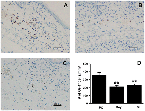 Fig. 3. Feeding mice with soybean and SI inhibits the infiltration of myeloid immune cells.