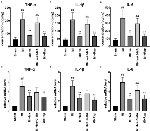 Figure 3. Effect of ivabradine on TNF-α, IL-1β, and IL-6 production of MI rats. Serum concentration of TNF-α (a), IL-1β (b), and IL-6 (c). mRNA expression levels of TNF-α (d), IL-1β (e), and IL-6 (f) in myocardial tissues. n = 6 hearts/group. Data were expressed as mean ± SD; ##P < 0.01 vs Sham group; **P < 0.01 vs MI group; &&P < 0.01 vs MI+Iva group. Abbreviations: 3-MA, 3-methyladenine; Iva, ivabradine; MI, myocardial infarction; Rap, rapamycin