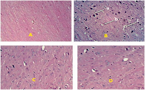 Figure 4. Effect of DCNPopt on histopathological changes of brain. A = Vehicle treated brain, B = Ketamine treated brain, C = Doxycycline hydrochloride treated brain, D = DCNPopt treated brain. ‘a’ – hyperchromatic nuclei, ‘b’ – perinuclear vacuolization, ‘c’ – dilated vascular channels.