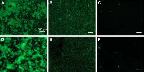 Figure 4 Fluorescence imaging of Staphylococcus aureus (A–C) and Staphylococcus epidermidis (D–F) after treating with Ag/AuNRs for 24 hours at a concentration of 0 (A, D), 15 (B, E) and 25 (C, F) µg/mL, respectively.