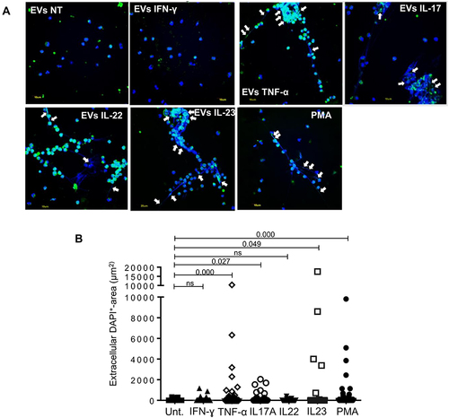 Figure 3 Keratinocyte-derived extracellular vesicles trigger netosis in vitro. (A) Healthy neutrophils were stimulated 3 hours with EV obtained from untreated HaCaTcells (NT) or previously treated with the indicated cytokines. Cells treated with the mitogen phorbol 12-myristate 13-acetate (PMA) is the positive control. Staining of the antimicrobial peptide LL37 was performed with AlexaFluor488-conjugated anti-human LL37 (green), and DNA filaments by a DNA dye (DAPI, blue). Scale bar is 10 µm. White arrows indicate extracellular LL37-DNA colocalizations. One experiment out of three is shown. (B) Neutrophils were treated as in (A). Extracellular traps were first identified as DAPI+ (DNA) filaments associated with LL37, and then the area covered by DNA was quantified on three images per condition. Each dot represents the area covered by the extracellular DNA strand. One representative experiment out of two is shown. Results are shown as mean with standard error of the mean. P-values by Wilcoxon matched-pairs signed rank test.