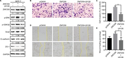 Figure 5 Invasion and migration promoted by ZNF259 were inhibited by the extracellular signal-regulated kinase (ERK) inhibitor U0126.Notes: (A) ZNF259 transfection could upregulate p-ERK, phosphorylated-glycogen synthase kinase 3β (p-GSK3β), and Snail expression, and downregulate E-cadherin and zonula occludens protein 1 (ZO-1) expression. All these effects could be restored by the incorporation of the ERK inhibitor U0126 (5 µM). The numbers indicated the relative expression ratios of protein. At least 3 separate experiments were performed. (B, C) Transwell assay showed that U0126 could reverse the ZNF259 transfection-caused increase in cell invasion ability (mean ± standard error of the mean, **P<0.01). (D, E) Wound healing assay also showed that U0126 could reverse the ZNF259 transfection-caused increase in cell migration ability (mean ± standard error of the mean, *P<0.05).Abbreviation: ZNF259, zinc finger protein 259.