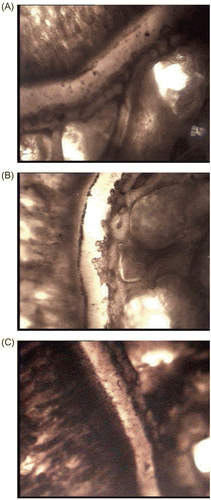 Figure 2.  Effect of alcohol and aqueous extracts of young prop roots of Ficus bengalensis on the proximal epiphyseal cartilage of the tibia of one-month-old immature rats. (A) Normal rat, (B) normal + alcohol extract (300 mg/kg), (C) Normal + aqueous extract (300 mg/kg).