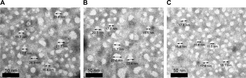 Figure 7 Transmission electron microscopy images of (A) TMAB-PEG-PAMAM-PTX, (B) TMAB-PEG-PAMAM-FITC, and (C) TMAB-PEG-PAMAM-Cy7.Abbreviations: TMAB, trastuzumab; PEG, polyethylene glycol; PAMAM, polyamidoamine; PTX, paclitaxel; FITC, fluorescein isothiocyanate; Cy7, cyanine7.