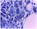 Figure 1: Ziehl Neelsen 100X magnification.