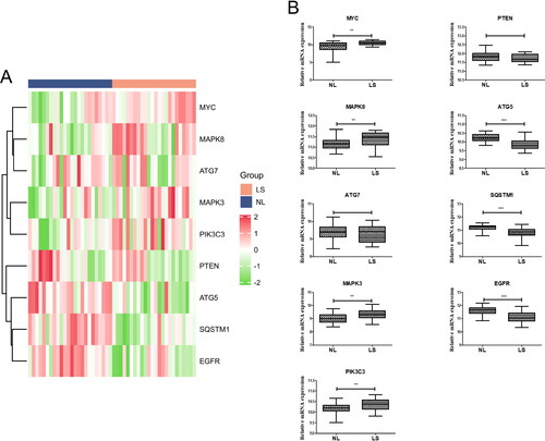 Figure 5. Validation of core genes. (A) Heatmaps of the 10 core DEARGs in the GSE41662 dataset. (B) mRNA expression of 10 core genes in the GSE41662 dataset.