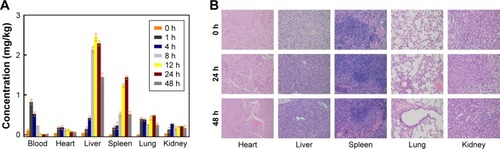 Figure 7 (A) In vivo bio-distribution (blood, heart, liver, spleen, lung, and kidney) studies of the Au-TEMPO NRs (0, 1, 4, 8, 12, 24, and 48 hours after injection). (B) Representative pathological images of main organs (heart, liver, spleen, lung, and kidney at 0, 24, and 48 hours after injection) after H&E staining.Abbreviation: Au-TEMPO NRs, nitroxide-radicals–modified gold nanorods.