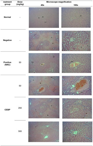 Figure 3. Histopathological studies of PCM-intoxicated liver tissue from rats pretreated with CEBP or NAC at 40x and 100x magnification. Liver tissue from the normal group showed normal liver architecture damaged by intoxication with 3 g/kg PCM as indicated by the apppearence of massive necrosis (N), hemorrhage (H), and inflammation (I). pretreatment with 5 mg/kg NAC reversed the PCM induced toxicity in the liver tissue causing moderate I as evidenced by the presence of neutrophils (Neu) and lymphoplasmacytic (LP) cells, whereas the portal tract exhibited a mild I as indicated by the presence of scattered Neu. On the other hand, pretreatment with 50 mg/kg CEBP failed to reverse the effect of PCM as indicated by the presence of a severe H with an area of N with infiltration of I cells and the presence of LP cells. Pretreatment with 250 mg/kg CEBP caused mild I in liver tissue, as indicated by the presence of lymphocytic cells (L) without N and H domains, with portal tract showing the presence of scattered I cells in the liver parenchyma. Finally, pretreatment with 500 mg/kg CEBP successfully reversed the toxic effect of PCM on liver tissue, as indicated by the absence of H, N, and I, whereas the portal tract showed only a mild infiltration of Neu in the liver parenchyma.