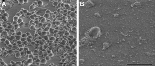 Figure 8 SEM images of (A) untreated Staphylococcus aureus (control) and (B) S. aureus treated with PEG-GNR. Scale bars: 2 μm.Abbreviations: GNR, gold nanorods; SEM, scanning electron microscope; PEG, polyethylene glycol.