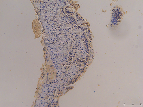 Figure 6 The immunohistochemical staining results of the control group were observed under 200X microscope.