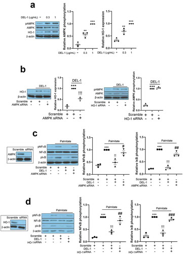Figure 3. AMPK/HO-1 contributes to the attenuation of inflammation and insulin resistance in 3T3-L1 adipocytes. (a) Western blot analysis of AMPK phosphorylation and HO-1 expression in differentiated 3T3-L1 cells treated with DEL-1 (0–1 μg/mL) for 24 h. (b) Western blot analysis of AMPK phosphorylation and HO-1 expression in AMPK or HO-1 siRNA-transfected 3T3-L1 adipocytes treated with DEL-1 (1 μg/mL) for 24 h. Western blot analysis of NFκB and IκB phosphorylation in AMPK (c) or HO-1 (d) siRNA-transfected 3T3-L1 myocytes treated with palmitate (200 μM) and DEL-1 (1 μg/mL) for 24 h. (e) ELISA for TNFα and MCP-1 release by AMPK or HO-1 siRNA-transfected 3T3-L1 adipocytes treated with DEL-1 (1 μg/mL) for 24 h. Western blot analysis of phosphorylation of IRS-1 and Akt and glucose uptake measurement (f) in AMPK or HO-1 siRNA-transfected 3T3-L1 adipocytes treated with 200 μM palmitate and DEL-1 (1 μg/mL) for 24 h. Human insulin (10 nM) stimulates insulin signalling for 3 min. Means ± SEM were obtained from three independent experiments. ***P < 0.001 when compared to control or insulin treatment. !!!P < 0.001, !!P < 0.01 and !P < 0.05 when compared to palmitate or insulin plus palmitate treatment. ###P < 0.001, ##P < 0.01 and #P < 0.05 when compared to the insulin, palmitate plus DEL-1 or insulin, palmitate plus DEL-1 treatment