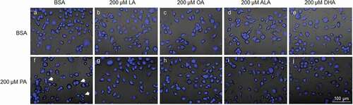 Figure 6. UFAs abolished PA-induced accumulation of binucleate cells. N2a cells were fixed, stained with DAPI, and imaged under confocal microscope following treatment with BSA or 200 µM PA together with different UFAs for 24 h. A-J. Representative overlay confocal microscopy images of cells treated with BSA (a-e) or 200 µM PA (f-j) together with 200 µM LA (b, g), OA (c, h), ALA (d, i), or DHA (e, j) in serum-free media for 24 h. Representative binucleate cells were marked by white arrows.