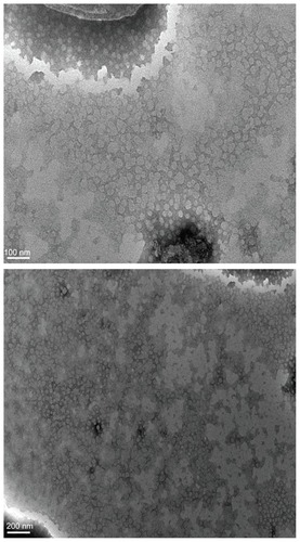 Figure 3 TEM photograph of S-SLN.Abbreviation: S-SLN, sorefenib solid lipid nanopraticles.