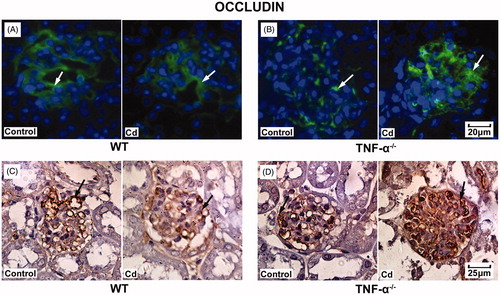 Figure 4. Effects of Cd on occludin protein expression in glomeruli from TNF-α−/− mice and WT mice. Representative result of occludin expression in WT mice (A) and TNF-α−/− mice (B) using immunofluorescence. Representative result of occludin expression in WT mice(C) and TNF-α−/− mice (D) using immunohistochemistry.