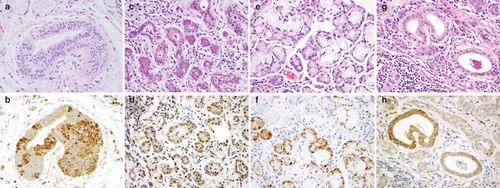 Figure 1. Histopathological and immunohistochemical findings of OAT1-4 in human submandibular gland. (A, C, E and G) Hematoxylin-eosin staining of serial sections for the corresponding OAT1-4 immunostained sections (B, D, F and H). (B) OAT1 is strongly expressed in the cytoplasm of striated ductal cells. (D) OAT2 is expressed in the cytoplasm of striated ductal cells and serous acinar cells, as well as in several nuclei. (F) OAT3 is strongly expressed in the whole cytoplasm and several nuclei of serous acinar cells. (H) OAT4 is expressed in the cytoplasm of striated ductal cells.