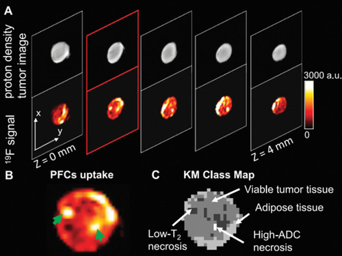 Figure 3 Anatomic images of PFC uptake in an HM-7 xenograft tumor at 9.4 T with a 1H/19F 10-mm surface coil.