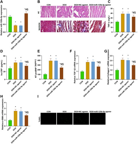 Figure 5. Overexpression of miR-125b-5p effectively improves myocardial fibrosis in DCM rats. A. RT-qPCR was utilized to detect miR-125b-5p expression in rats of each group. B. HE and masson stainings were employed to observe the histologic changes of myocardial pathology in rats. C-E. ELISA was adopted to measure the levels of TNF-α, hs-CRP, and NT-proBNP in rats of each group. F-H. RT-qPCR was implemented to test the expression of TGF-1β, collagenI, and α-SMA factors in rats of each group. I. TUNEL staining was performed to examine apoptotic cardiomyocytes in rats of each group. * p < 0.05 vs. CON group; # p < 0.05 vs. DOX group; $ p < 0.05 vs. DOX + NC agomir group.