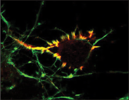 Figure 1 CaMKIIβ(red) highly colocalizes with F-actin (green) in discrete F-actin rich structures in an embryonic cortical neuron. These F-actin rich protrusions are enriched around or underneath the cell body. CaMKIIβ binding to F-actin is regulated by calcium signals and is important for the F-actin filament stability. Image courtesy of Yu-Chih Lin and Lori Redmond.