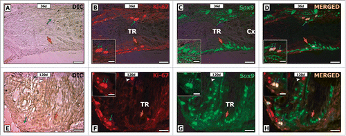 Figure 9. Double-label immunofluorescence for Ki-67 (B, F) and Sox-9 (C, G) in pre-pubertal (A-D) and adult (E-H) Wistar rats. As it can be seen, some Sox-9 positive Sertoli cells was also Ki-67 positive (blue arrow D, H). Otherwise, other Sox-9 positive Sertoli cells were negative for Ki-67 (orange arrow D, H). Few proliferative germ cells were also observed in the TR (white arrowhead H). TR: transition region; Cx: area adjacent to the TR. Bar: 50 μm.