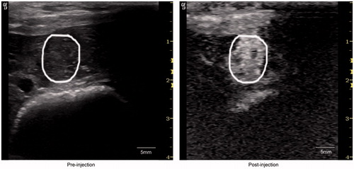 Figure 3 Ultrasound imaging (9L, GE, logIQ9, USA) of liver cancer of rabbit pre-injection and post–injection of ADM-NMCs. The circles indicate the tumor.