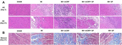 Figure 7 Effects of mCRP and the JNK inhibitor (SP600125) on histopathological changes in mice. (A) Representative images of HE staining of infarction area (200× magnification) at 7d and 21d post-MI in mice in each group. Scale bars 100 μm. (B) Representative images of Masson trichrome staining of infarction tissue in each group (200× magnification) at 21 d post-MI in mice. Scale bars 100 μm.