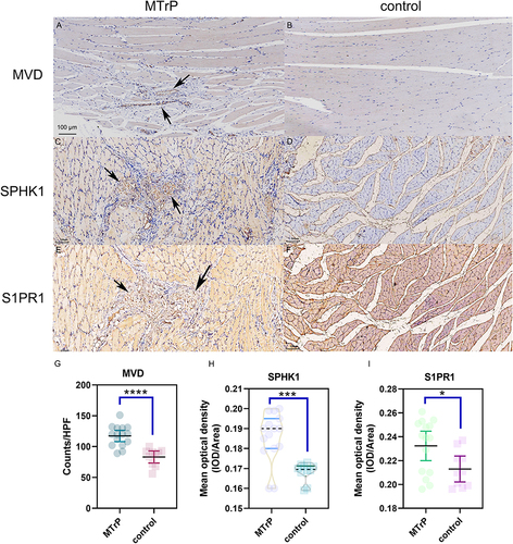 Figure 4 Immunohistochemistry results. (A and B) The cytoplasm of vascular endothelial cells in the vastus medialis muscles of the rats was stained brownish-yellow with an antibody against the CD31 protein. The contraction nodules in the MTrP group contained more brown, positive particles (black arrows) compared with those in the control group. (C and D) The SPHK1 expression in the MTrP group were greater than those in the control group (black arrows). (E and F) The S1PR1 expression in the MTrP group were greater than those in the control group (black arrows). (G–I) Showing MVD, SPHK1 and S1PR1 expression levels between groups. *Compared to the MTrP group, p < 0.05; ***p < 0.001; ****p < 0.0001. The data were analysed by the independent-sample t-test, except for SPHK1, for which the two-sided Mann‒Whitney U-test was used; repetitions=3.