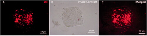 Figure 2. DiI labelled iPSCs colony Fluorescence image of iPSCs colony that labelled by DiI (A) Phase-contrast microscopy of iPSCs colony morphology. (B) Merged image of iPSCs and DiI labelled colony (C).