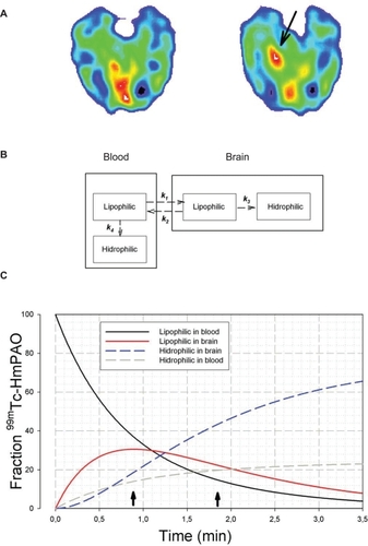 Figure 2 SPECT results and mathematical model of blood-brain 99mTc-HmPAO distribution. A) Basal (left) and etomidate-activated (right) SPECT recordings. The arrow shows the hyperperfusion on the right temporo-occipital area (around fusiform and lingual gyri) that corresponds to the most occipital FO electrodes. B) Kinetic model for numerical solution of distribution for lipophilic and hydrophilic 99mTc-HmPAO in blood and brain, according to a four-compartment model. The first-order rate constants are (min−1) k1 = 0.81; k2 = 0.35; k3 = 0.92 and k4 = 0.25 -CitationAndersen 1989; C) Kinetic evolution of the model during the first 3.5 min after 99mTc-HmPAO iv perfusion that shows the distribution in the different compartments; the broken-blue line represents the evolution of intracellular hydrophilic radio-tracer. The first arrow (from left) marks the start of seizure and the second one indicates the end.
