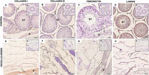 Figure 3. Rat testis immunohistochemistry. (A–D) Control testis samples and decellularized samples ECM (E–H). Both control and decellularized testis showed a positive reaction for collagen I (A, E), collagen III (B, F), fibronectin (C, G), and laminin (D, H), with laminin expression being apparently higher in both control and decellularized testis. From this, it is possible to observe that the components of the ECM were preserved after decellularization (EH). Arrow (positive expression); asterisk (negative control); seminiferous tube (ST); interstice (I); Testicular parenchyma (P). (B) and (D–H) 50 µm; (C) 20 µm.