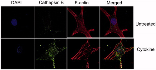 Figure 2. Increased cellular cathepsin during cytokine treatment of human chondrocytes. OA human-derived chondrocytes were obtained following an informed consent from individuals undergoing total knee replacement (Hadassah Institutional approval obtained). Chondrocytes were isolated and cultured, treated (Cytokine: 50 ng/ml TNFα+2 ng/ml IL1β, 24 h) and stained as previously described (Dvir-Ginzberg et al., Citation2011; Oppenheimer et al., Citation2012). Cells stained with DAPI (i.e. nuclei in blue fluorescence), cathepsin B (i.e. active cathepsin B in green florescence), Phalloidine (i.e. F-actin filaments in red florescence), × 600 magnification. The images clearly show that cytokine treatment renders increased cathepsin B levels throughout the cell compartment, as well as the nucleus. The micrographs are representative images of data previously described by Oppenheimer et al., Arthritis and Rheumatology (Oppenheimer et al., Citation2012).