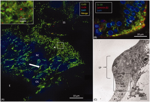 Figure 6. A: SR-SIM of outer sulcus (OS) epithelium and root cells (RCs) at the basal turn of the human cochlea (maximum-intensity projection). Larger Cx30-positive epithelial GJ plaques are seen in the nuclear region (filled arrow). In the basal region of the RCs, large numbers of smaller Cx30-positive plaques are expressed (*). A few Cx26-positive plaques are intertwined among the basal Cx30 plaques (inset of framed area). The sub-epithelial space (SS) also expresses Cx30 in type II fibrocytes. B: Immunofluorescence of laminin/Cx30 co-labeling (*) shows that this network is located between the epithelial root cell processes. C: The corresponding region seen with TEM. BM: basilar membrane; E: endolymph; SP: spiral prominence.