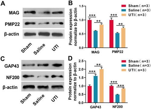 Figure 2 UTI was beneficial for myelinogenesis and nerve regeneration after sciatic nerve injury. (A) and (B) MAG and PMP22 expressions were analyzed by Western blot, n = 3/group. (C and D) GAP43 and NF200 expressions were analyzed by Western blot, n = 3/group. **P < 0.01, and ***P < 0.001.