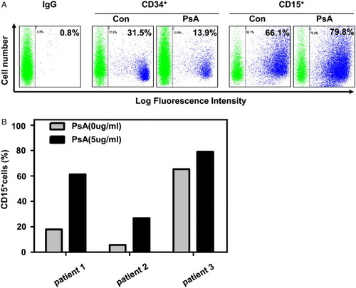 Figure 2 PsA induce differentiate in primary AML cells (A) CD34+ and CD15+ cells were detected after the primary AML cells treated with 5 μg/ml PsA for 72 hours. (B) CD15+ cells were detected in three de novo AML patients primary cells treated with 5 μg/ml PsA for 72 hours.