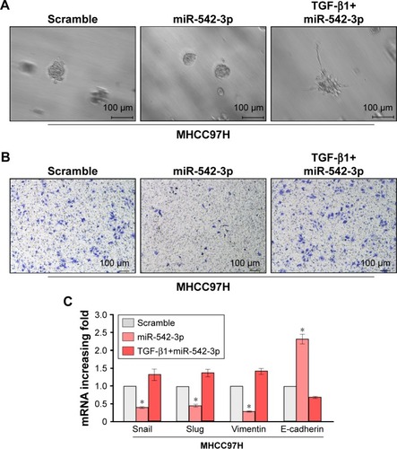 Figure 4 TGF-β/Smad signaling pathway is required for cancer metastasis by silencing miR-542-3p.