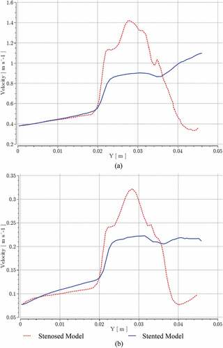 Figure 15. Velocity variation for stenosed and stented models at; (a) near peak systole, (b) peak diastole.