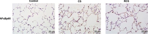 Figure 5 Effects of rosiglitazone on the expression of the NFκB p65 in alveolar epithelial cells as determined by immunohistochemistry.