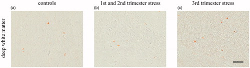 Figure 8. Effects of chronic maternal stress on cell proliferation in white matter of fetal sheep brain at 0.87 gestation. Representative photomicrographs of cell proliferation (ki-67 immunohistochemistry, brown precipitation) of the deep white matter (a–c). Stress during the first and second trimester but not stress during the third trimester decreased cell proliferation seen by the lower number of ki-67 marked cells. Scale bar 50 µm.