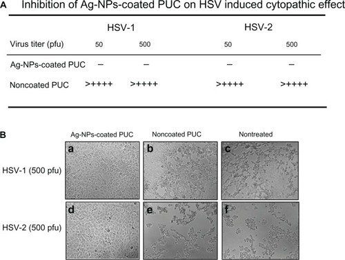 Figure 7 The inhibitory effect of the Ag-NPs-coated PUC on HSV infection.Notes: Different titers (pfu) of HSV-1 or HSV-2 virus in 200 μL of DMEM were first incubated with the Ag-NPs-coated PUC or noncoated condom for 30 minutes. Then, the virus-containing medium was used to infect Vero-E6 cells in 24-well plates. After 48 hours, the virus-induced cytopathic effects (lesion) were observed under microscope and the cytopathic lesions in five views were counted and calculated as lesions per well. (−) no HSV-induced cytopathic lesion; (+) average two cytopathic lesions/view; (++) two cytopathic lesions/view; (+++) three cytopathic lesions/view; (++++) four cytopathic lesions/view.Abbreviations: Ag-NPs, silver nanoparticles; UC, polyurethane condom; HSV, herpes simplex virus; DMEM, Dulbecco’s modified Eagle’s medium; PFU, plaque-forming units.