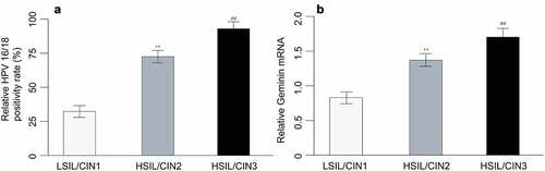 Figure 1. HPV 16/18 positivity rate (a) and geminin mRNA expression in cervix tissues of LSIL/CIN1, HSIL/CIN2 and HSIL/CIN3 participants with a P value of less than 0.05