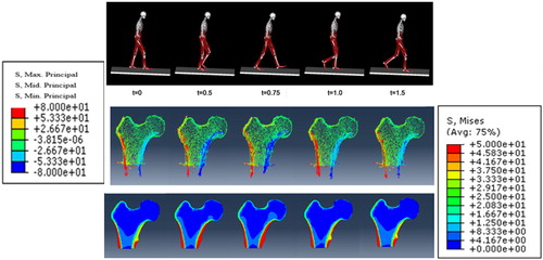 Figure 2. Five positions of the leg during gate and corresponding stress distribution in the femoral head.