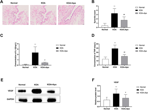 Figure 4 Acupotomy improved synovial inflammation and angiogenesis. (A) Representative synovial tissues of each group stained with HE staining, 200×. (B) Krenn pathological scale in each group. **P < 0.01 vs the Normal group. ##P < 0.01 vs the KOA group. (C and D) The concentration of IL-1β and TNF-α in rabbits in each group. **P < 0.01 vs the Normal group. #P < 0.05, ##P < 0.01 vs the KOA group. (E) Typical protein bands for each group. (F) Protein level comparison of VEGF between groups. **P < 0.01 vs the Normal group. #P < 0.05 vs the KOA group. Data were analyzed by Image J.