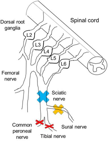 Figure 1 Injury sites of each peripheral nerve injury model. The sciatic nerve branches into the tibial nerve, peroneal nerve, and sural nerve. The sural nerve includes only sensory fibers. In model 1, the sciatic nerve was ligated and resected (blue cross). In model 2, the sural nerve was resected (yellow cross). In model 3 (the spared nerve injury [SNI] model), both motor nerves were resected and the sensory nerve was preserved (red cross). In model 4, the animals underwent a sham operation. Only the SNI models showed mechanical hypersensitivity. Three weeks after the surgery, we isolated lumbar dorsal root ganglia (L3, 4, and 5) and compared DNA expression patterns among the groups.