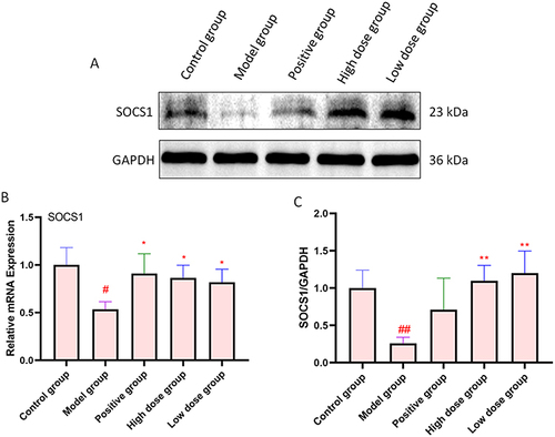 Figure 4 AFPR increased the expression of SOCS1 in the brain of CUMS rats. (A) Western blotting of SOCS1 protein. (B) Relative mRNA expression of SOCS1 in the brain of CUMS rats; (C) Quantitative results of SOCS1 protein, Normalized to GAPDH. Data are represented as the mean ± SD (n=3). #P< 0.05, ##P< 0.01 compared to the control group, *P< 0.05, **P< 0.01 compared to the model group.