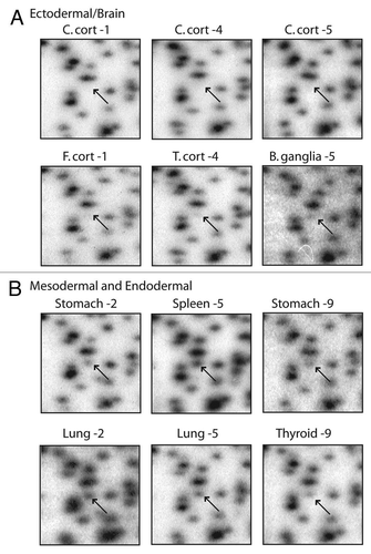 Figure 3 RLGS profiles of spot 3D46 showing neural vs. non-neural tissue specificity. (A) The spot is absent (top) or faintly present (bottom) in ectodermal tissues (C. cortex, T. cortex and B. ganglia). (B) In mesodermal and endodermal tissues (stomach, spleen, lung and thyroid) the spot is clearly present, hence unmethylated. Abbreviations: B. gang, basal ganglia; C. cort, cerebellar cortex; C. white, cerebellar white matter; F. white, frontal lobe white matter; T. cort, temporal lobe cortex.