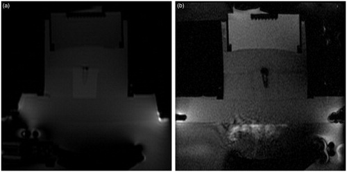 Figure 11. Magnetic resonance phase images of a typical thermosensitive phantom (TSP) containing drug-loaded PEG-MSNs (a) prior and (b) during sonication. Formation of a dark region around the container shows the uniform distribution of thermal energy within the container.
